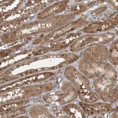 Immunohistochemistry: FBXL17 Antibody [NBP2-32663]