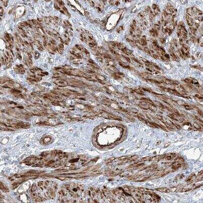 Immunohistochemistry-Paraffin: FBXL17 Antibody [NBP1-84204]