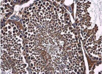 Immunohistochemistry-Paraffin: FBXL17 Antibody [NBP2-16439]