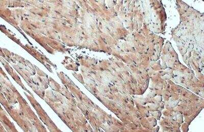 Immunohistochemistry-Paraffin: FBXL17 Antibody [NBP2-16439]