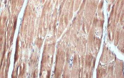 Immunohistochemistry-Paraffin: FBXL17 Antibody [NBP2-16439]