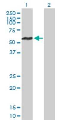 Western Blot: FBXL17 Antibody [H00064839-B01P]