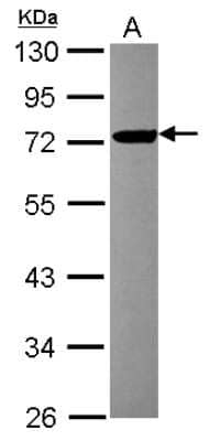 Western Blot: FBXL17 Antibody [NBP2-16439]