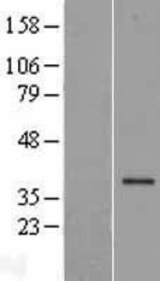 Western Blot: FBXL17 Overexpression Lysate [NBP2-06401]