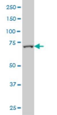 Western Blot: FBXL18 Antibody (3H5) [H00080028-M01]