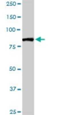 Western Blot: FBXL18 Antibody [H00080028-D01P]