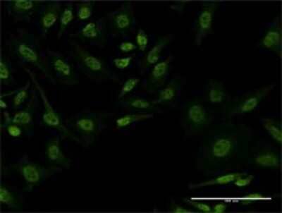 Immunocytochemistry/ Immunofluorescence: FBXL19 Antibody (3C5) [H00054620-M03]