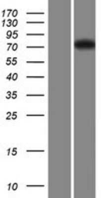 Western Blot: FBXL19 Overexpression Lysate [NBP2-08300]