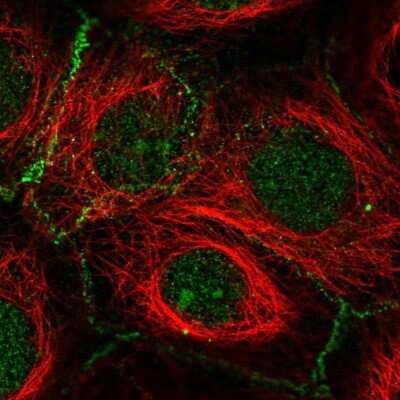 Immunocytochemistry/ Immunofluorescence: FBXL2 Antibody [NBP2-57616]