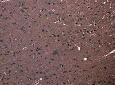 Immunohistochemistry-Paraffin: FBXL2 Antibody [NB100-1289]