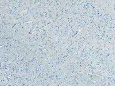 Immunohistochemistry-Paraffin: FBXL2 Antibody [NB100-1289]