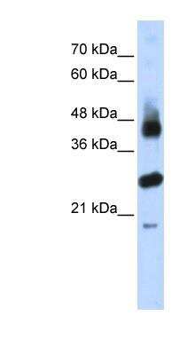 Western Blot: FBXL2 Antibody [NBP1-55279]