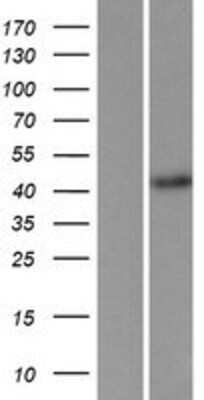 Western Blot: FBXL2 Overexpression Lysate [NBP2-07479]