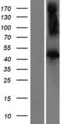 Western Blot: FBXL2 Overexpression Lysate [NBP2-10249]