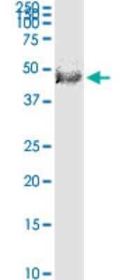 Western Blot: FBXL20 Antibody (2G1) [H00084961-M03]