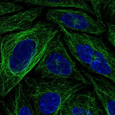 Immunocytochemistry/ Immunofluorescence: FBXL20 Antibody [NBP2-48960]