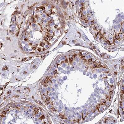 Immunohistochemistry: FBXL20 Antibody [NBP2-47458]
