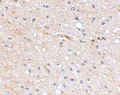 Immunohistochemistry-Paraffin: FBXL20 Antibody - BSA Free [NBP1-77317]