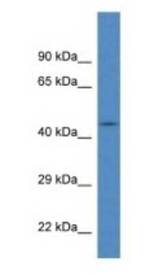 Western Blot: FBXL20 Antibody [NBP1-74271]