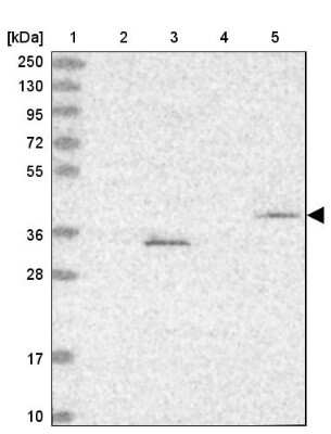 Western Blot: FBXL20 Antibody [NBP2-47458]