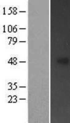 Western Blot: FBXL20 Overexpression Lysate [NBP2-05964]