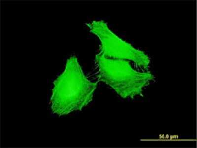 Immunocytochemistry/ Immunofluorescence: FBXL22 Antibody (1B6) [H00283807-M01]