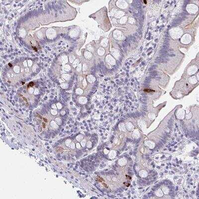 Immunohistochemistry-Paraffin: FBXL22 Antibody [NBP2-33724]