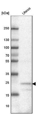 Western Blot: FBXL22 Antibody [NBP2-14011]