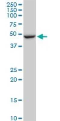 Western Blot: FBXL3 Antibody (1A3) [H00026224-M03]