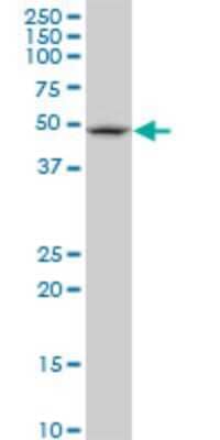 Western Blot: FBXL3 Antibody (1A3) [H00026224-M03]
