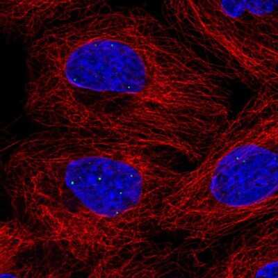 Immunocytochemistry/ Immunofluorescence: FBXL3 Antibody [NBP2-56645]