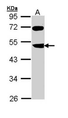 Western Blot: FBXL3 Antibody [NBP1-32979]