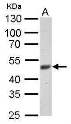 Western Blot: FBXL3 Antibody [NBP1-32979]