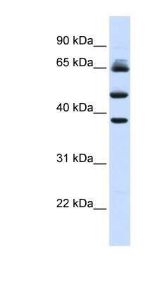 Western Blot: FBXL3 Antibody [NBP1-53021]