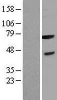 Western Blot: FBXL3 Overexpression Lysate [NBP2-04326]