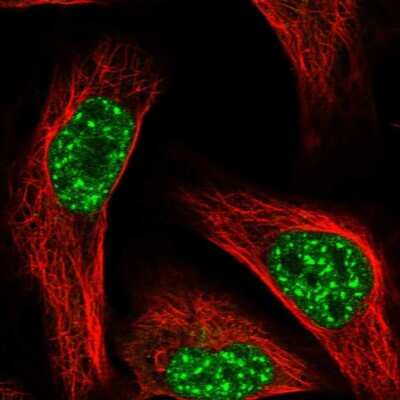 Immunocytochemistry/ Immunofluorescence: FBXL4 Antibody [NBP1-84727]