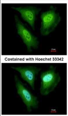 Immunocytochemistry/ Immunofluorescence: FBXL4 Antibody [NBP2-16441]