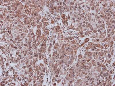Immunohistochemistry-Paraffin: FBXL4 Antibody [NBP2-16440]
