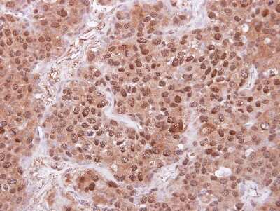 Immunohistochemistry-Paraffin: FBXL4 Antibody [NBP2-16441]