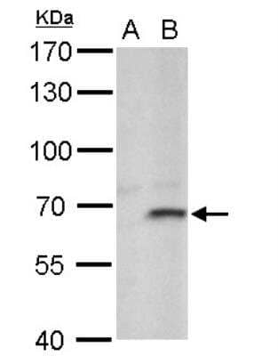 Western Blot: FBXL4 Antibody [NBP2-16440]