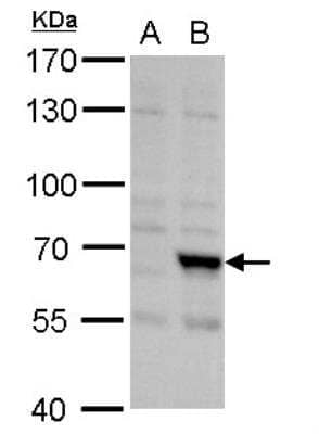 Western Blot: FBXL4 Antibody [NBP2-16441]