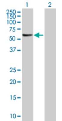 Western Blot: FBXL6 Antibody [H00026233-B01P]