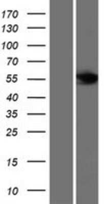 Western Blot: FBXL6 Overexpression Lysate [NBP2-06318]