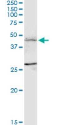 Western Blot: FBXL7 Antibody (2G10) [H00023194-M01]