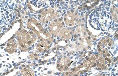 Immunohistochemistry: FBXL7 Antibody [NBP1-55053]