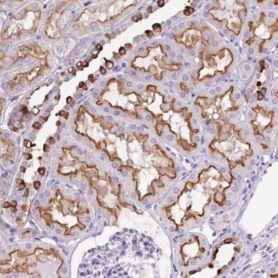 Immunohistochemistry: FBXL7 Antibody [NBP2-49184]