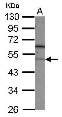 Western Blot: FBXL7 Antibody [NBP2-16443]
