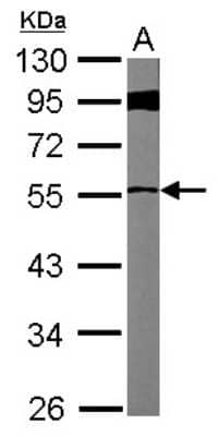 Western Blot: FBXL7 Antibody [NBP2-16443]