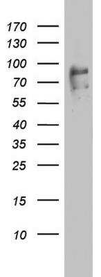 Western Blot: FBXO11 Antibody (OTI1F6) [NBP2-45620]