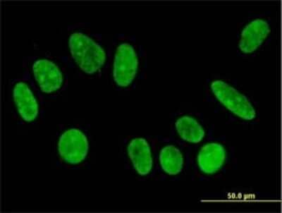 Immunocytochemistry/ Immunofluorescence: FBXO11 Antibody (4C12) [H00080204-M01]